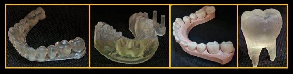 Modele zebow wykonane z zywicy na drukarce 3D pomagajace w planowaniu leczenia dentystyczn Fot Monika Topa Skwarczynska - Nasza Politechnika Modele zębów wykonane z żywicy na drukarce 3D, pomagające w planowaniu leczenia dentystycznego Fot.: Monika Topa-Skwarczyńska